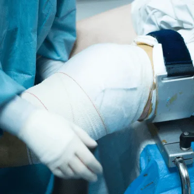 Artrosis en CDMX: evaluación y tratamiento del desgaste articular