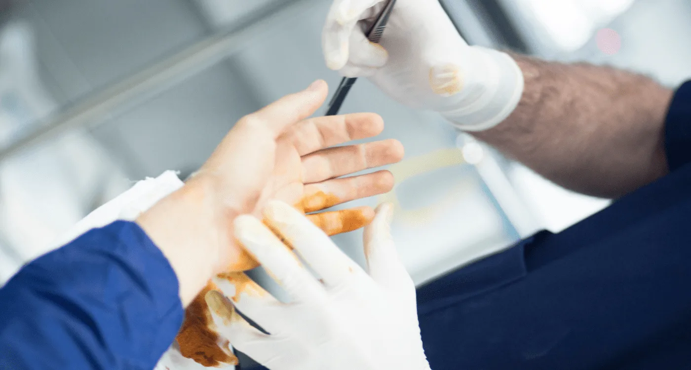 ¿Qué especialista trata las fracturas?