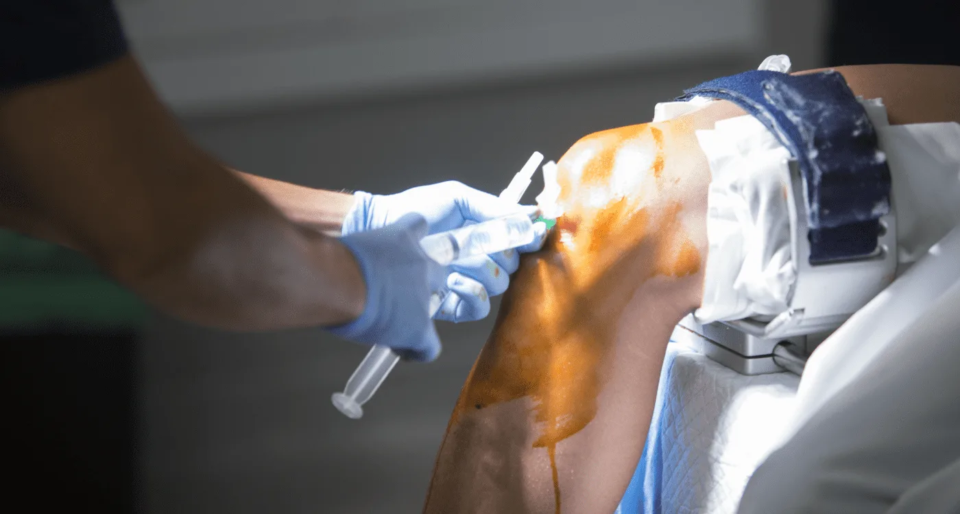 Especialista en tratamiento integral para la lesión de ligamentos en CDMX