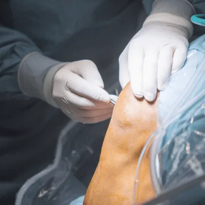 Especialista en el tratamiento de lesiones musculares en CDMX